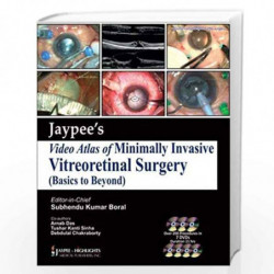 Jaypee Video Atlas Of Minimally Invasive Vitreoretinal Surgery by BORAL Book-9789350902004