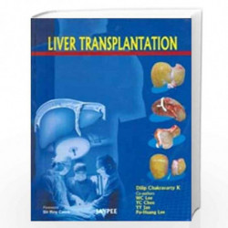 Liver Transplantation by CHAKRAVARTY Book-9788184487701