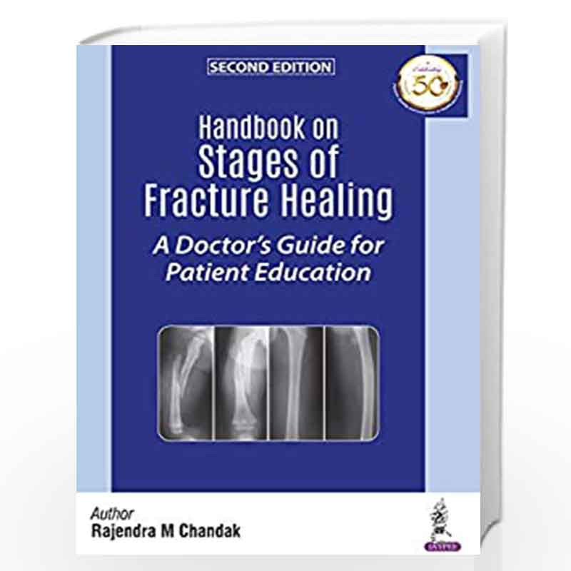 Handbook on Stages of Fracture Healing: A Doctors Guide for Patient Education: A Doctor's Guide for Patient Education by CHANDAK