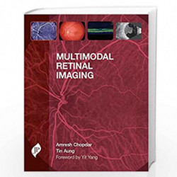 Multimodal Retinal Imaging by CHOPDAR AMRESH Book-9781907816604