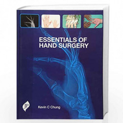 Essentials of Hand Surgery by CHUNG KEVIN C Book-9781907816321