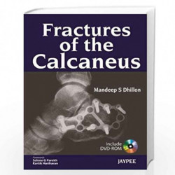 Fractures Of The Calcaneus With Dvd-Rom by DHILLON S MANDEEP Book-9789350903438