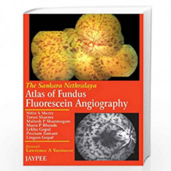 (Old)The Sankara Nethralaya Atlas of Fundus Fluorescein Anagiography by DUTTA DILIP KUMAR Book-9789350904459