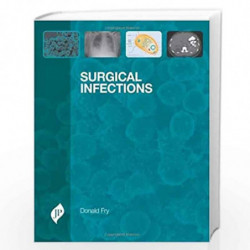 SURGICAL INFECTIONS by FRY DONALD Book-9781907816260