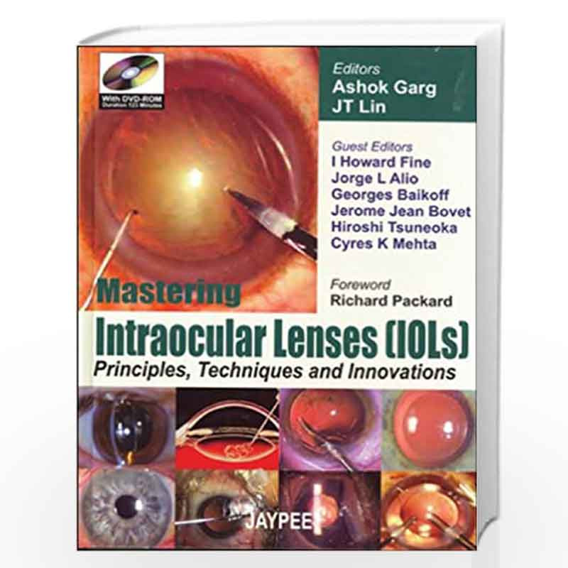 Mastering Intraocular Lenses (IOLs): Pric., Tech.& Innovations (with DVD ROM) by GARG Book-9788180619502