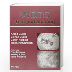 Uveitis Text And Imaging by GUPTA Book-9788184484915