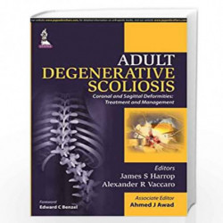 Adult Degenerative Scoliosis Coronal And Sagittal Deformities: Treatment And Management by HARROP JAMES S Book-9789351524960
