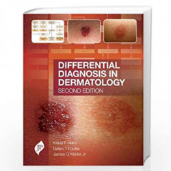 Differential Diagnosis in Dermatology: Second Edition by HELM KLAUS F. Book-9781909836198