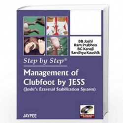 Step By Step Management Of Clubfoot By Jess With Int.Dvd-Rom by HERMAN MARTIN J Book-9789351521204