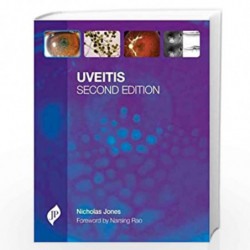 Uveitis With Cd-Rom by JONES Book-9781907816185