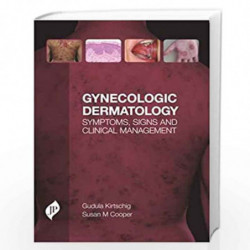 Gynecologic Dermatology: Symptoms, Signs and Clinical Management by KIRTSCHING GUDULA Book-9781909836013