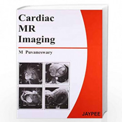 Cardiac Mr Imaging by KUMAR Book-9788180617409