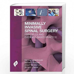 Minimally Invasive Spinal Surgery: Principles and Evidence-Based Practice by LEWANDROWSKI Book-9781909836105