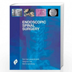 Endoscopic Spinal Surgery by LEWANDROWSKI Book-9781907816277