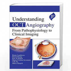Understanding OCT Angiography from Pathophysiology to Clinical Imaging by Lumbroso, Bruno Book-9781909836938