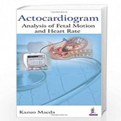 Actocardiogram:Analysis Of Fetal Motion And Heart Rate by MAEDA KAZUO Book-9789352501861
