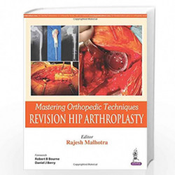 Mastering Orthopedic Techniques Revision Hip Arthroplasty: Revision Total Hip Arthroplasty by MALHOTRA RAJESH Book-9789351524861