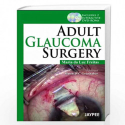 Adult Glaucoma Surgery Includes 2 Int.Dvd-Roms by MARIA DA LUZ FREITAS Book-9789350903551
