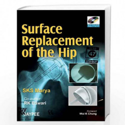 Surface Replacement of the Hip (with DVD ROM) by MARYA Book-9788180619656
