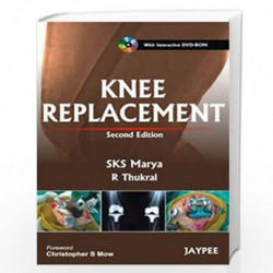 Knee Replacement With Interactive Dvd-Rom by MARYA SKS,THUKRAL Book-9789350251683