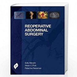 Reoperative Abdominal Surgery by MIZRAHI SOLLY Book-9781907816550