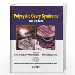 Polycystic Ovary Syndrome An Update: An Update(FOGSI) by MUKHERJEE Book-9788180619892