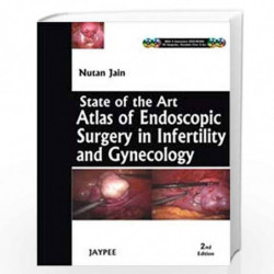 State Of The Art Atlas Of Endoscopic Surgery In Infertility And Gynecology With 4 Dvd-Roms: Atlas and Endoscopy Surgery in Infer