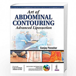 Art Of Abdominal Contouring Advanced Liposuction With Dvd-Rom by PARASHAR SANJAY Book-9789352500239
