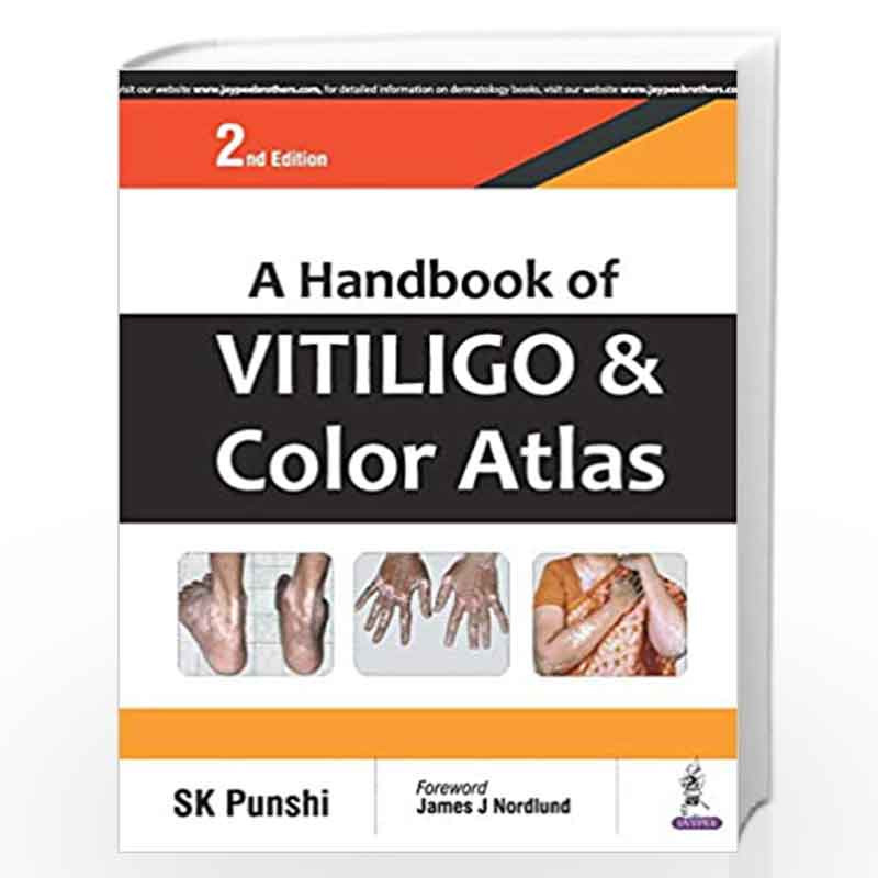 A Handbook of Vitiligo & Color Atlas by PUNSHI SK Book-9789352701506