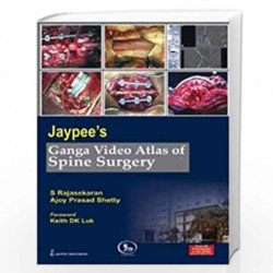 Jaypee'S Ganga Video Atlas Of Spine Surgery Over 50 Proc.In 6 Dvds by RAJASEKARAN S Book-9788184488852