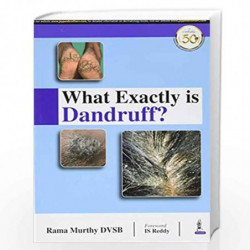 What Exactly is Dandruff? by RAMA MURTHY DVSB Book-9789351522379