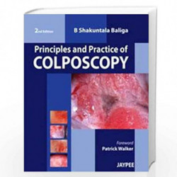 Principles And Practice Of Colposcopy by RAMAIAH Book-9789350253380