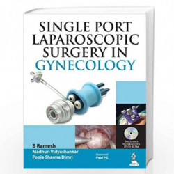 Single Port Laparoscopic Surgery In Gynecology Includes Dvd-Rom by RAMESH B Book-9789350906385