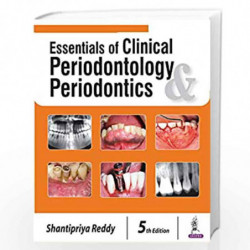 Essentials of Clinical Periodontology and Periodontics by REDDY SHANTIPRIYA Book-9789352701117