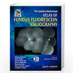 The Sankara Nethralaya Atlas of Fundus Fluorescein Angiography with Photo DVD-ROM by RISHI PUKHRAJ Book-9789350255773