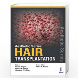 Aesthetic Series:Hair Transplantation by ROGERS NICOLE Book-9789351529323