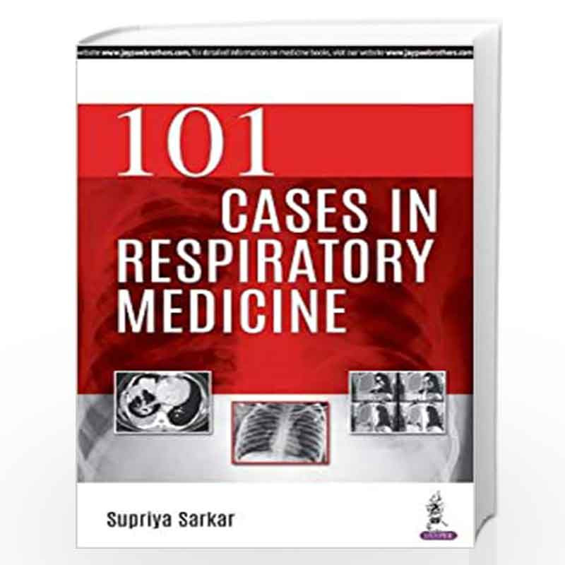 101 Cases In Respiratory Medicine by SARKAR SUPRIYA Book-9789352703111