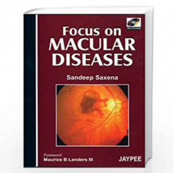 Focus On Macular Diseases With Dvd-Rom by SAXENA Book-9788180619533