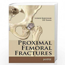 Proximal Femoral Fractures by SAXENA RICHA Book-9789351521037