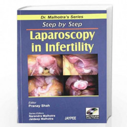 Step By Step Laparoscopy In Infertility With Dvd-Rom (Dr.Malhotra'S Series) by SHAH Book-9788184480047