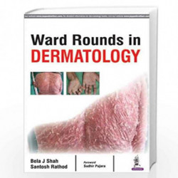 Ward Rounds In Dermatology by SHAH BELA J Book-9789386322685