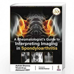 A Rheumatologists Guide to Interpreting Imaging in Spondyloarthritis by SHARMA ASHISH Book-9789389776959