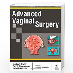 Advanced Vaginal Surgery by SHETH SHIRISH S Book-9789352700172