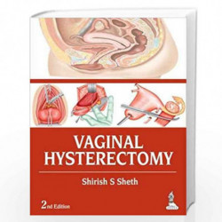 Vaginal Hysterectomy by SHETH SHIRISH S Book-9789351521792