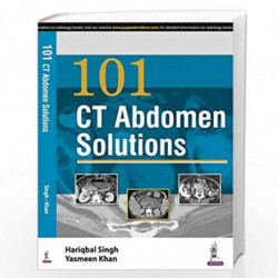 101 Ct Abdomen Solutions by SINGH HARIQBAL Book-9789352501816
