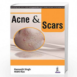 Acne & Scars by SINGH RAMANJIT Book-9789351529699