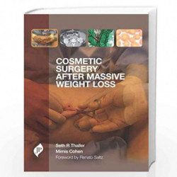 Cosmetic Surgery After Massive Weight Loss by THALLER SETH R,COHEN Book-9781907816284
