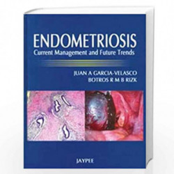 Endometriosis: Current Management and Future Trends by VELASCO Book-9788184488081
