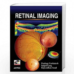 Retinal Imaging With Photo Dvd-Rom by VENKATESH Book-9788184481891