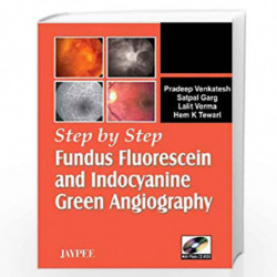 Step By Step Fundus Fluorescein And Indocyanine Green Angiography With Photo Cd Rom by VENKATESH Book-9788184480870
